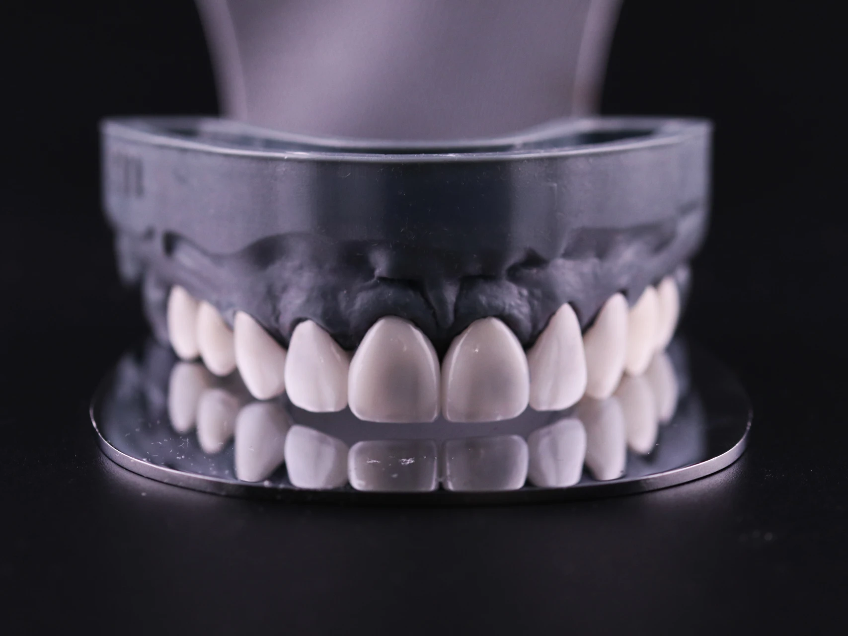 Upper jaw model showing porcelain veneers